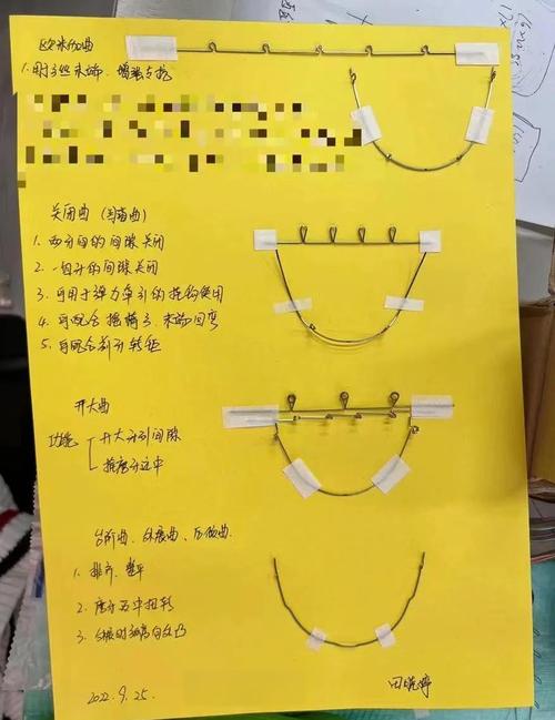 口腔正畸流程简介-图1 口腔正畸流程简介-图1