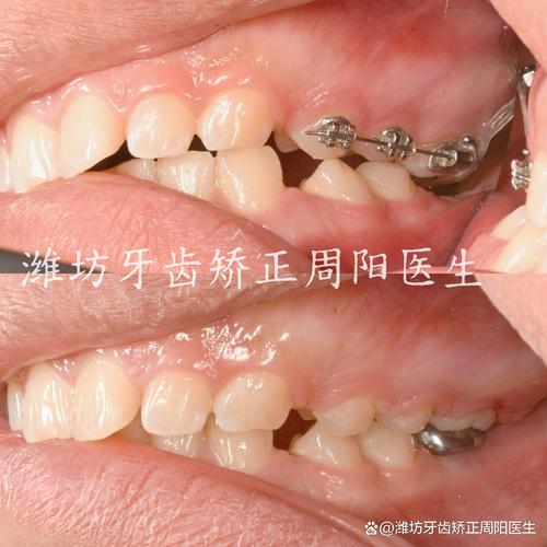 精于种植专于正畸-图2