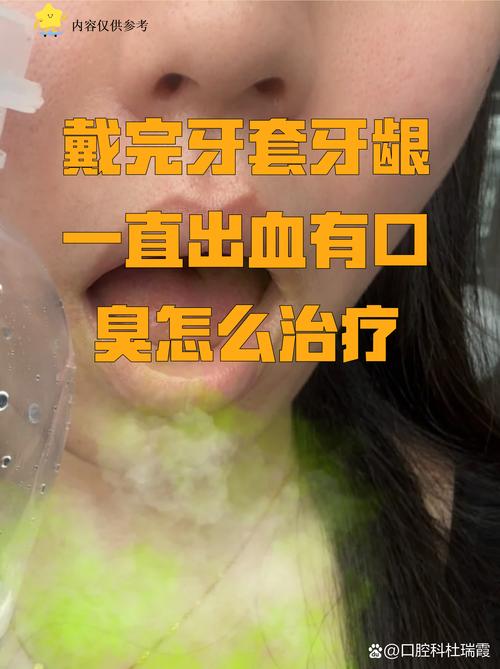 正畸牙龈出血严重-图3