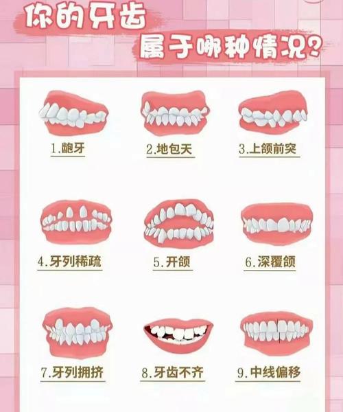 正畸牙齿调整位置,牙齿如何一步步移动到位?-图2 正畸牙齿调整位置,牙齿如何一步步移动到位?-图2