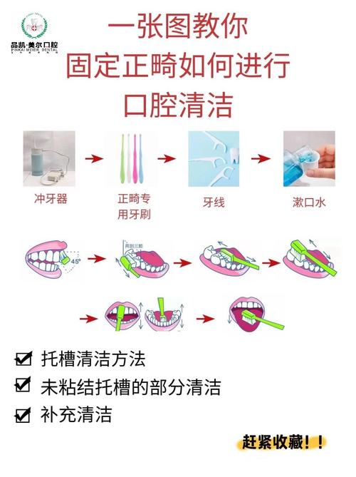 正畸期间怎么清洁-图1