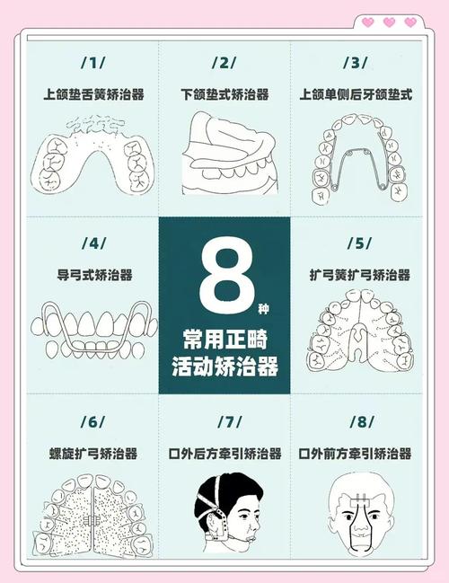 口腔正畸矫治体系-图3 口腔正畸矫治体系-图3