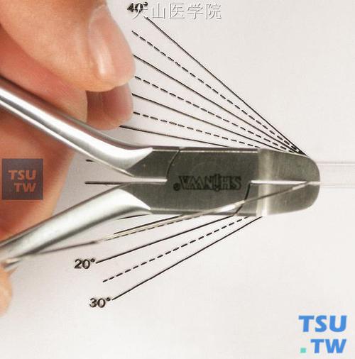 口腔正畸转矩,临床应用技巧如何精准掌握?-图2 口腔正畸转矩,临床应用技巧如何精准掌握?-图2