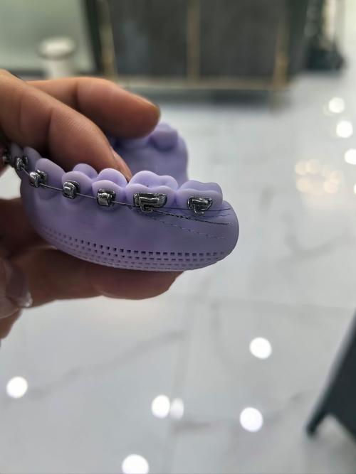 牙科正畸模型展示-图1