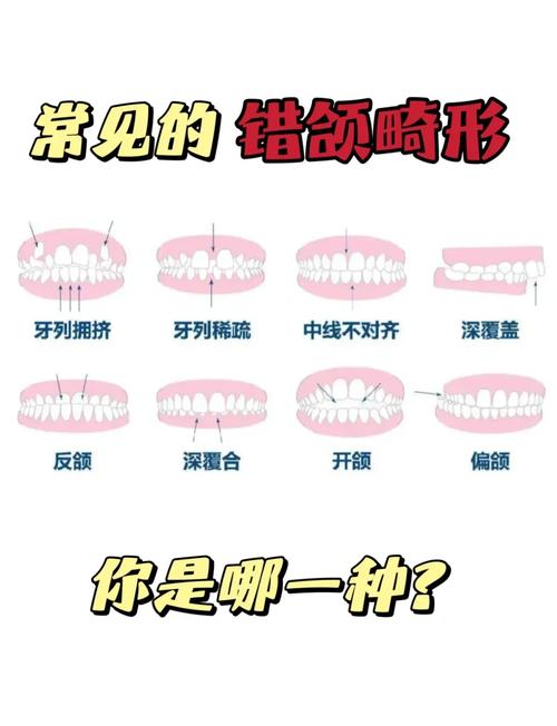 正畸面型分类图片-图1