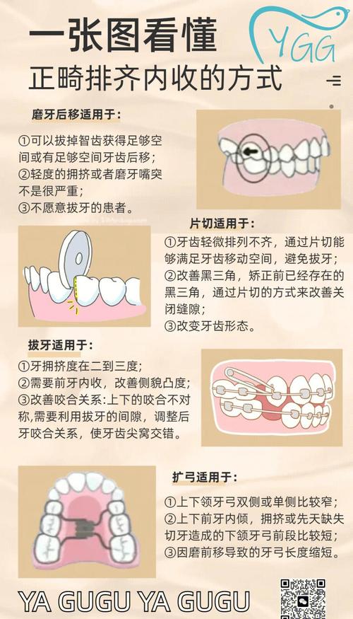 正畸如何高效排齐-图2