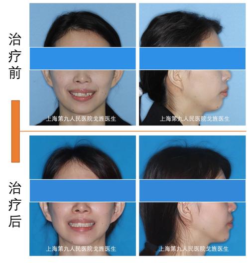 成人正畸完成病历-图2