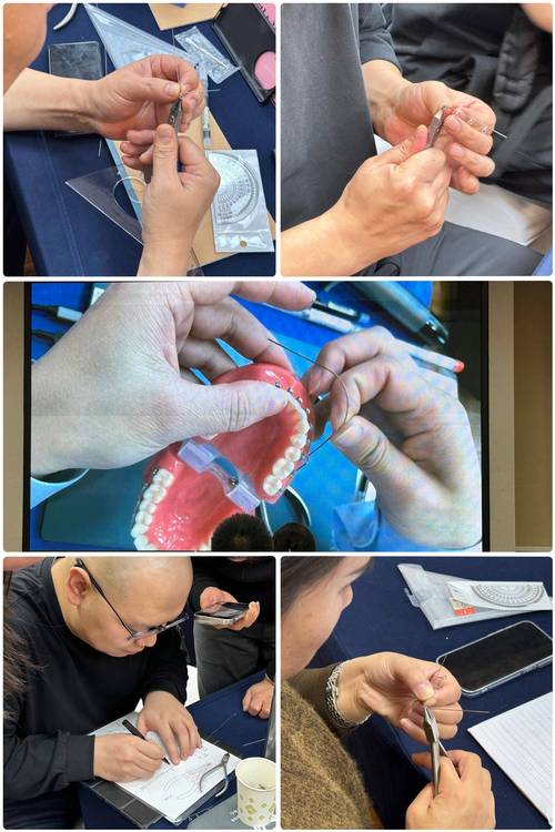 口腔正畸护理技术，日常护理的正确方法和注意事项有哪些？-图3