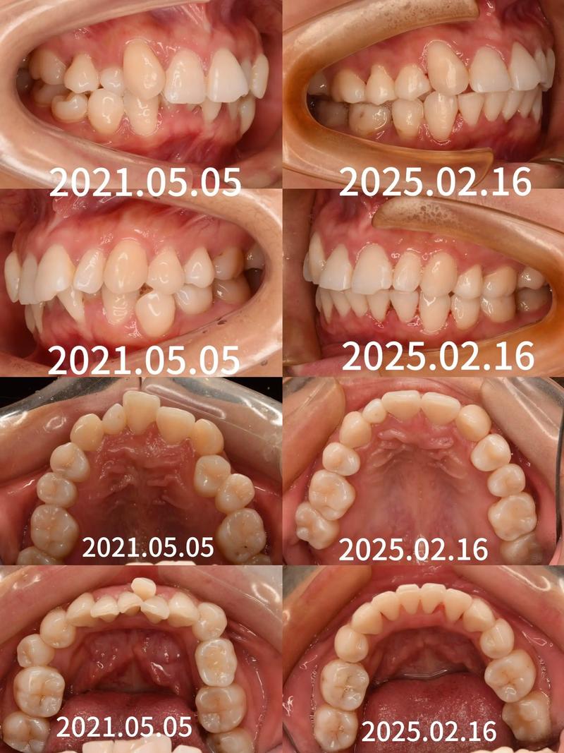 龙岩牙齿正畸去哪里做？求推荐靠谱口腔机构-图2