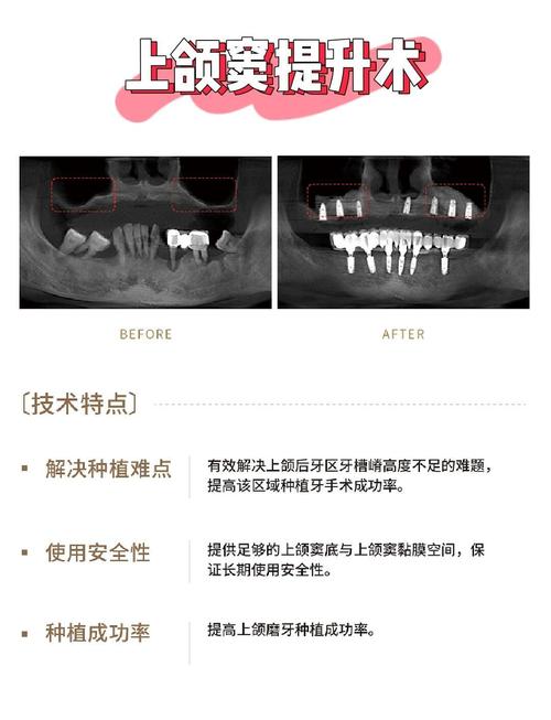 如何提升正畸业务的核心竞争力？-图3