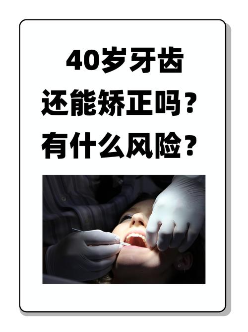 成人正畸牙齿矫正存在哪些风险?-图1 成人正畸牙齿矫正存在哪些风险?-图1