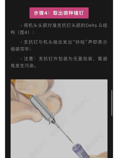 正畸种植支抗的独特优势有哪些？临床效果如何？-图2