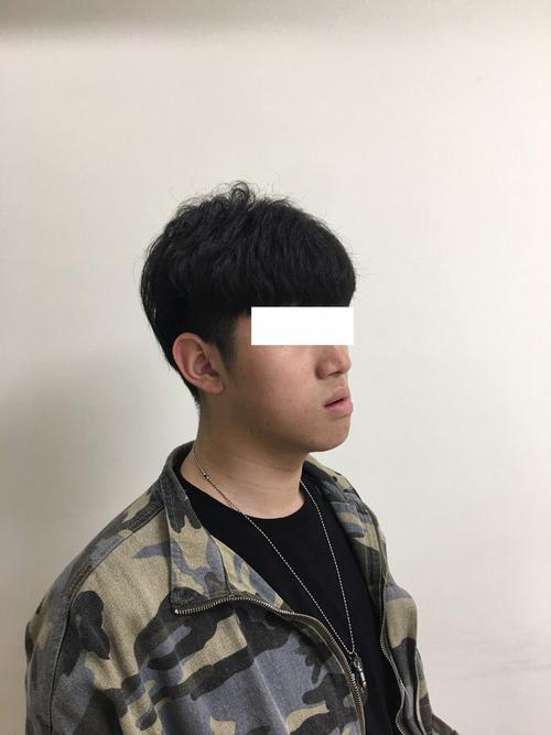 齐齐哈尔偏颌正畸-图2 齐齐哈尔偏颌正畸-图2