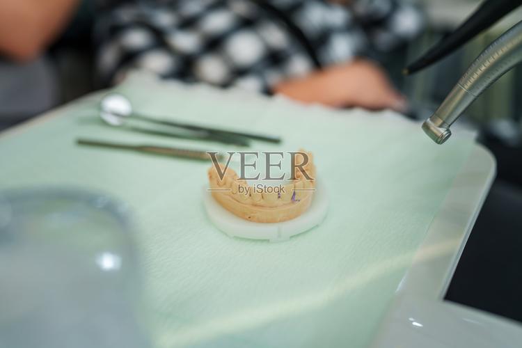 正畸石膏模型拍照-图1