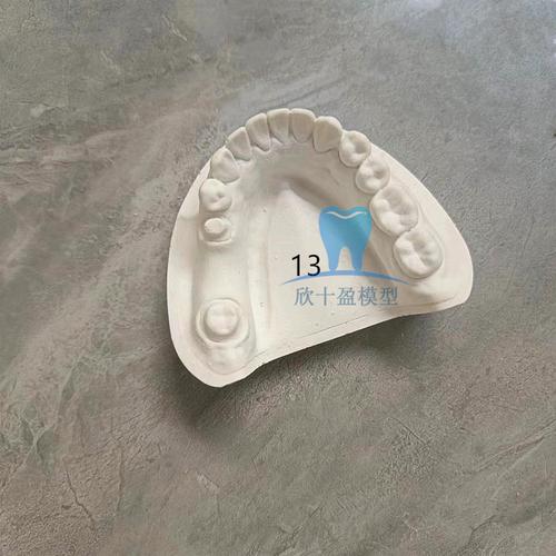 正畸石膏模型拍照-图3