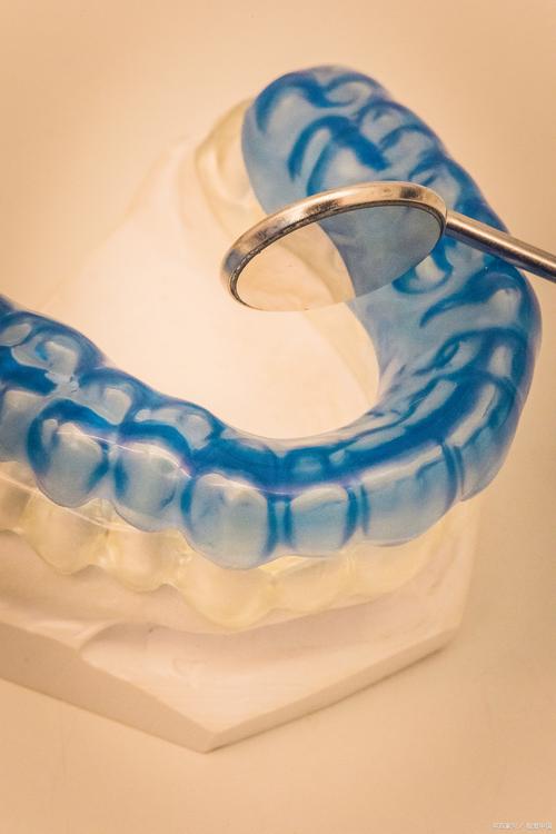 牙齿正畸spee-图2 牙齿正畸spee-图2