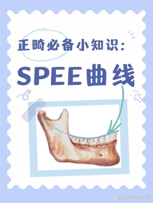 正畸speep曲-图1