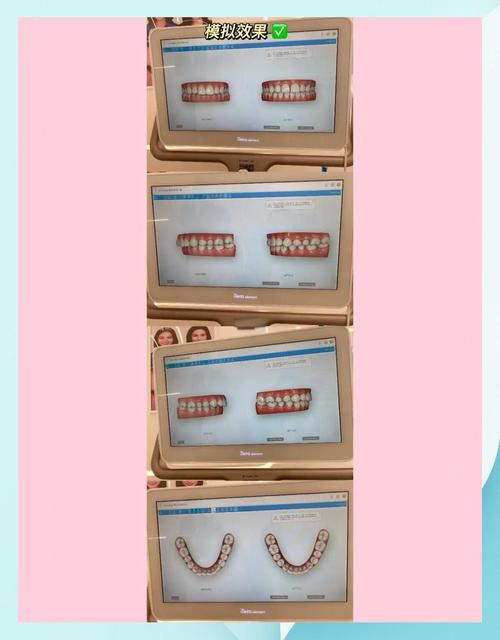 正畸mrcpop-图2 正畸mrcpop-图2