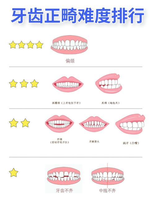 骨性值不值得正畸-图2
