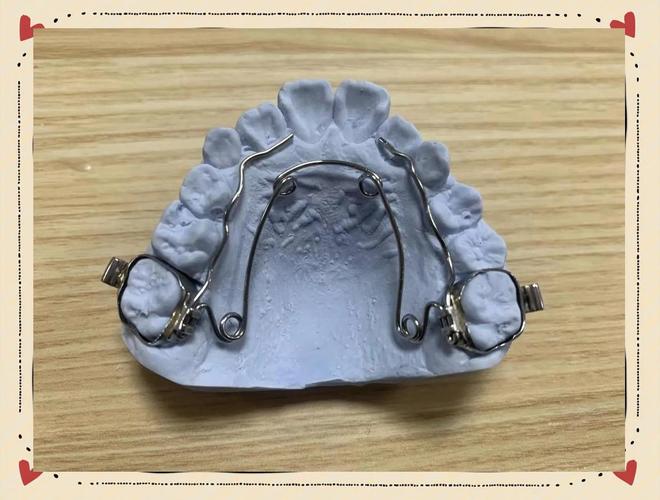 哈尔滨医大一正畸效果好不好？值得信赖吗？-图2