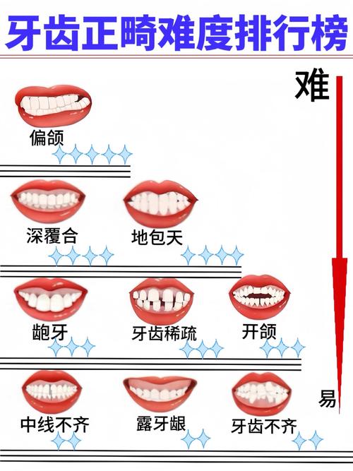 正畸中的面型分类-图1 正畸中的面型分类-图1
