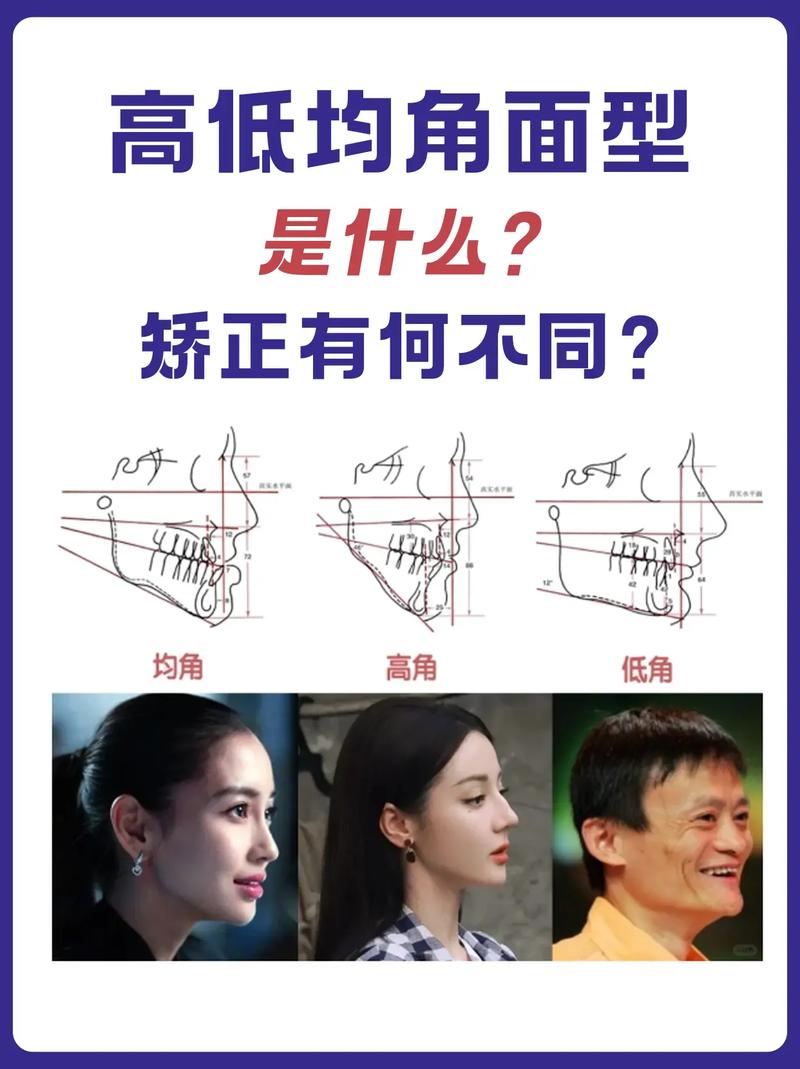 正畸中的面型分类-图3 正畸中的面型分类-图3