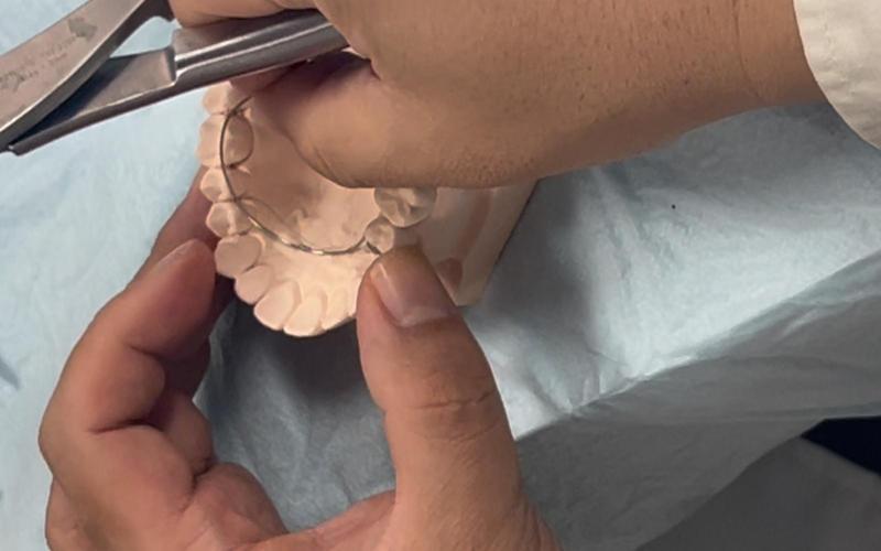 正畸末端回弯视频-图2