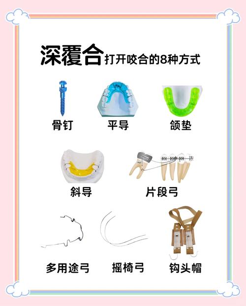 正畸推簧怎么安装?详细步骤与注意事项有哪些?-图1 正畸推簧怎么安装?详细步骤与注意事项有哪些?-图1