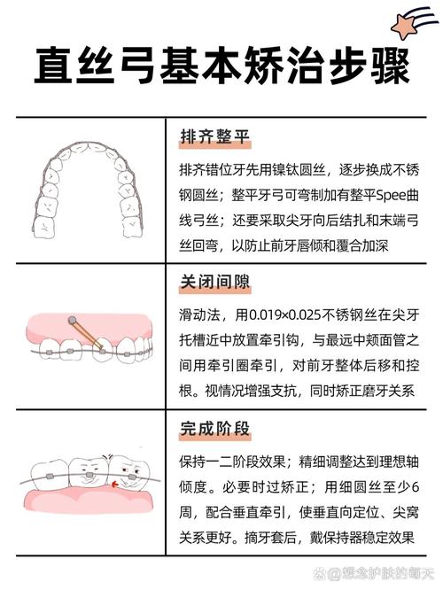正畸弓丝更换顺序有何讲究？不同阶段为何这样换？-图1