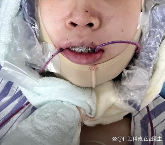 正畸医生仅三例临床经验，患者能放心托付吗？-图3