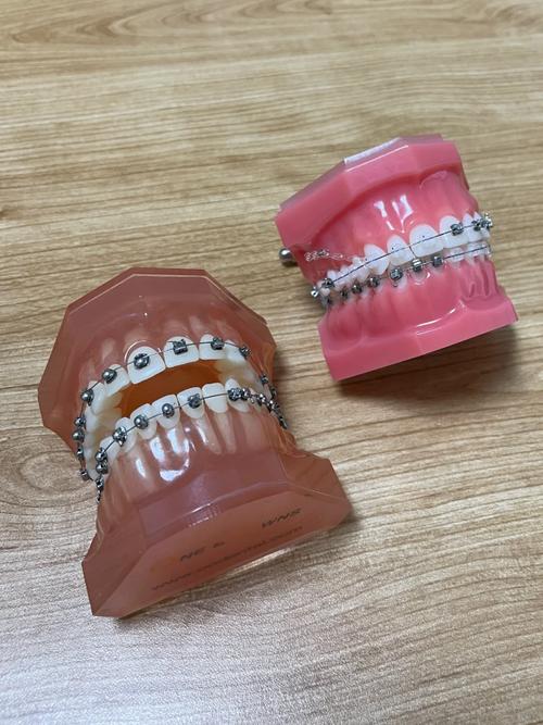 江苏省口腔正畸哪家医院更专业?-图1 江苏省口腔正畸哪家医院更专业?-图1