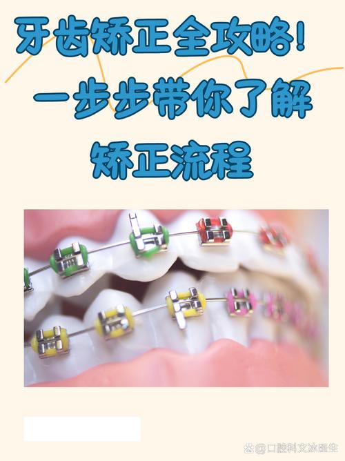 口腔正畸拍照的标准流程是怎样的？-图3