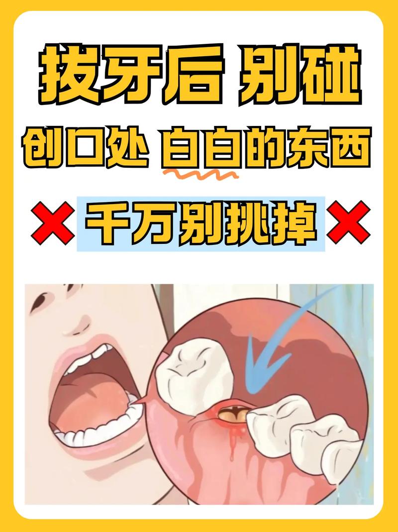 正畸拔牙疼不疼？矫正拔牙过程痛苦吗？-图3