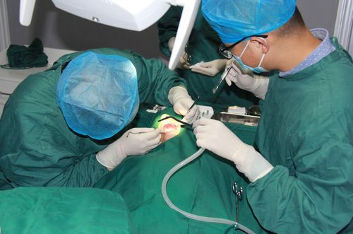 牙齿正畸为何需外科手术?效果与风险如何?-图2 牙齿正畸为何需外科手术?效果与风险如何?-图2