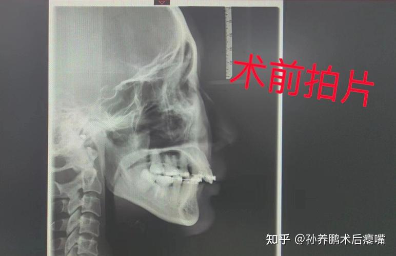 中山光华进修正畸-图2