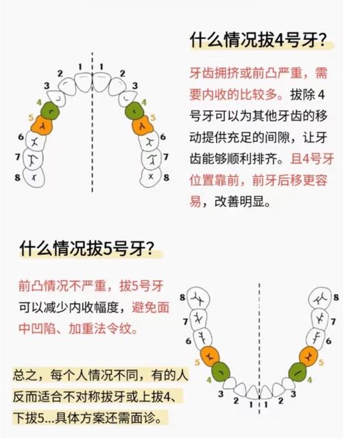 正畸拔牙间隔几天合适？时间安排有讲究吗？-图2