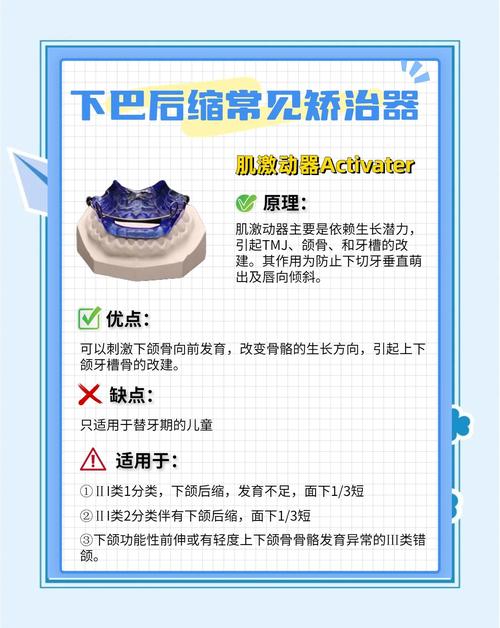 正畸矫正下巴后缩-图1