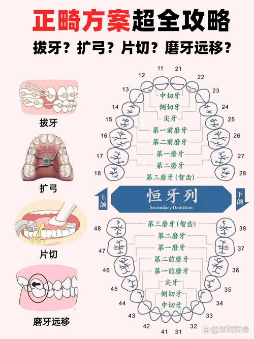 正畸拔牙拔哪几颗-图2