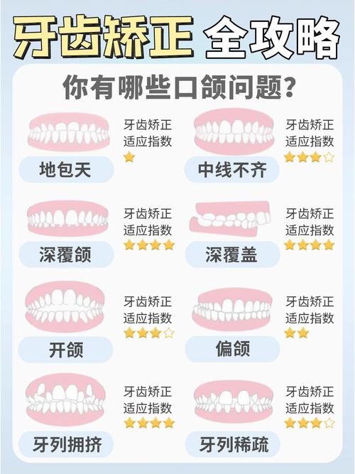 哪些牙齿问题或状况需要通过正畸治疗来改善？-图3