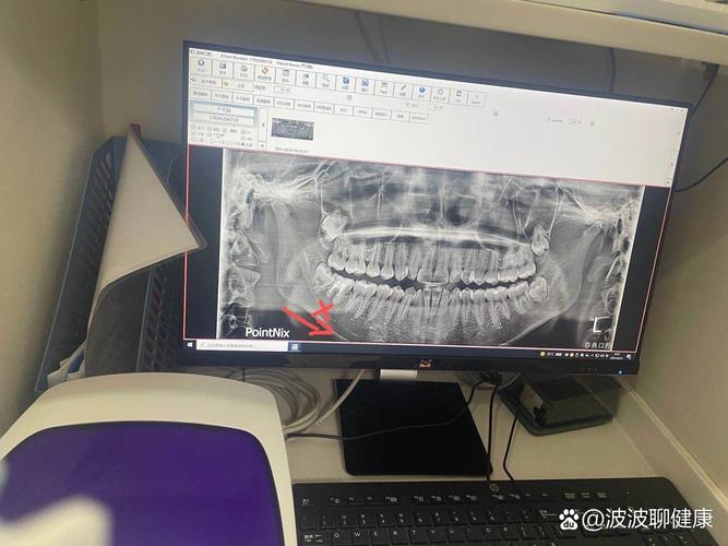 宁波口腔医院正畸-图1 宁波口腔医院正畸-图1