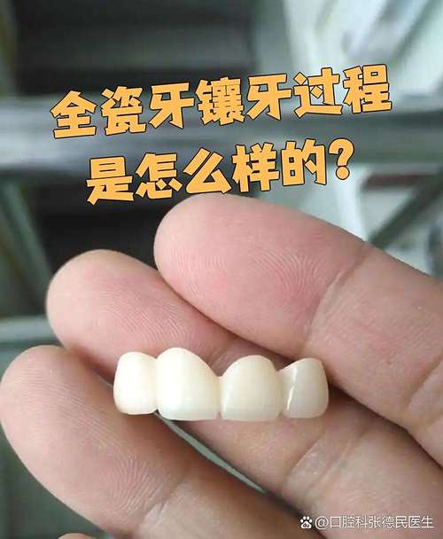 烤瓷牙还能正畸吗-图2