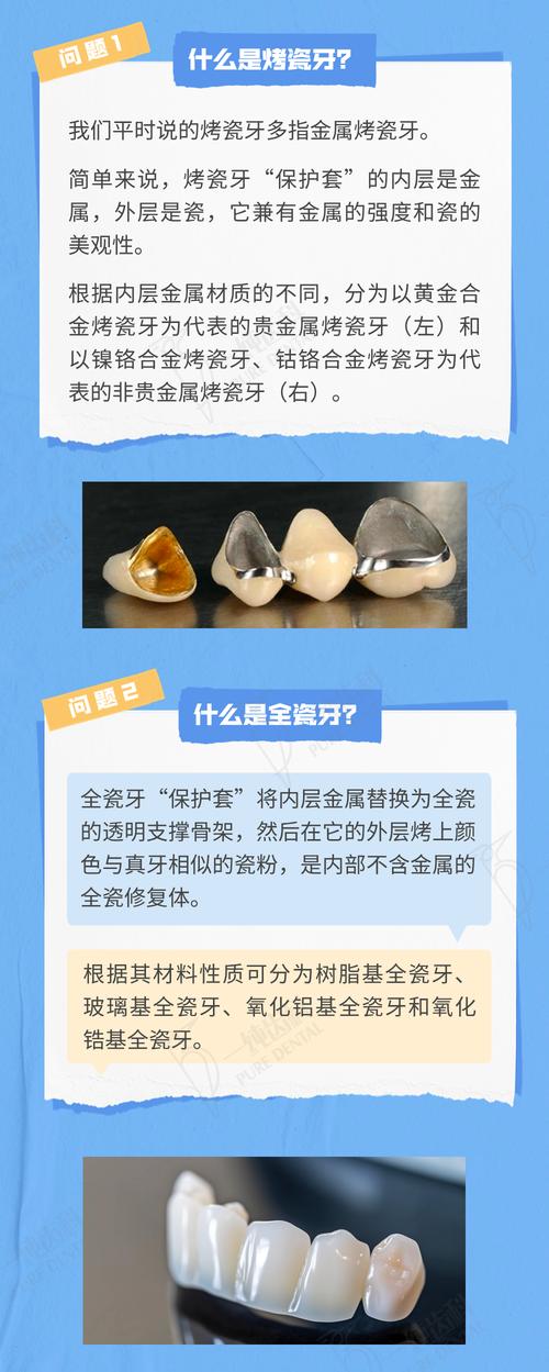 烤瓷牙还能正畸吗-图3