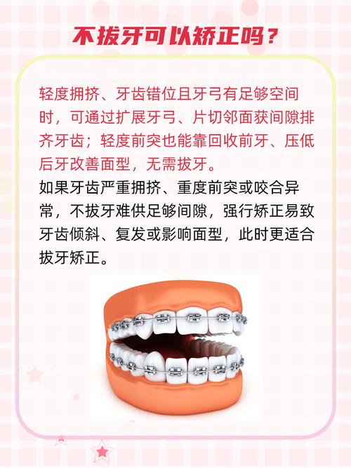 不拔牙正畸可以吗-图2