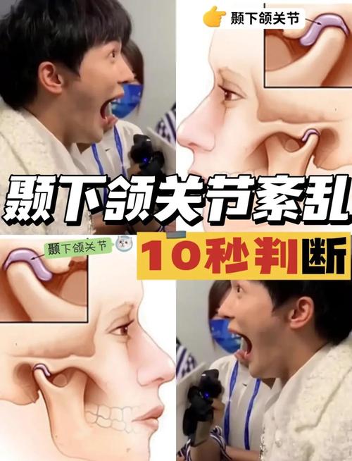 正畸和颞下颌关节-图2