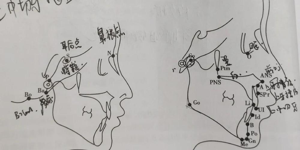 口腔正畸投影测量-图2