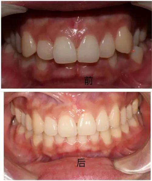 浙四口腔正畸宋-图2