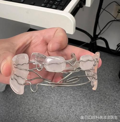 固定数字化正畸-图2