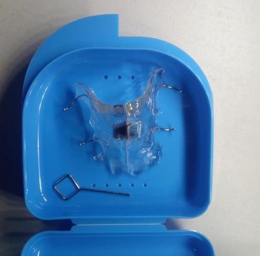 用弓丝扩弓正畸-图2