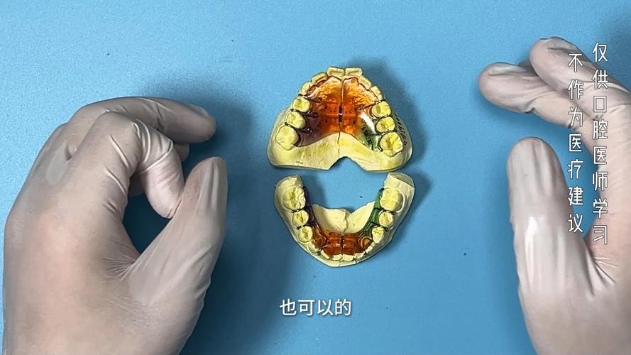 用弓丝扩弓正畸-图3