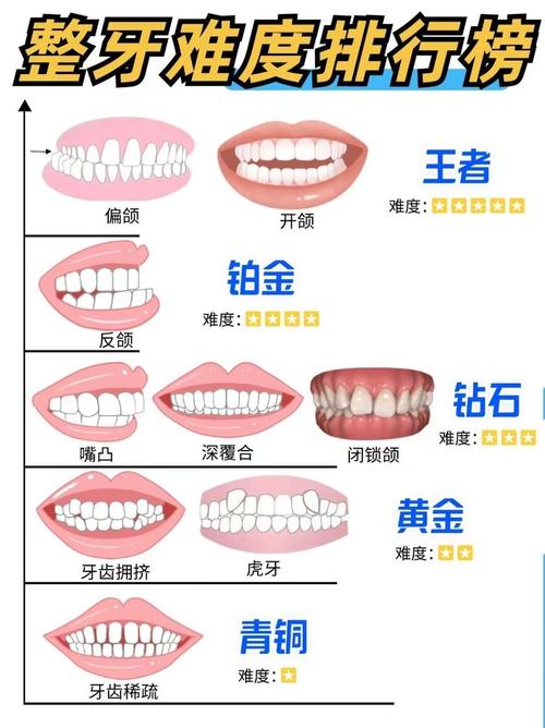 正畸力大小范围-图1 正畸力大小范围-图1